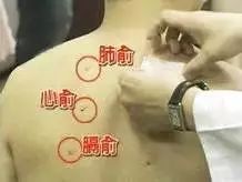 贴药方法 文字最后.jpg